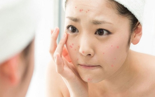 Những dấu hiệu có kinh trước 1 tuần dễ nhận viết 3 dấu hiệu có kinh 2
