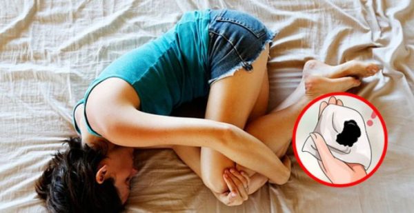 Kinh nguyệt màu đen là bệnh gì?