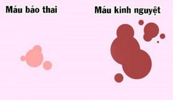 Phân biệt máu báo thai và kinh nguyệt