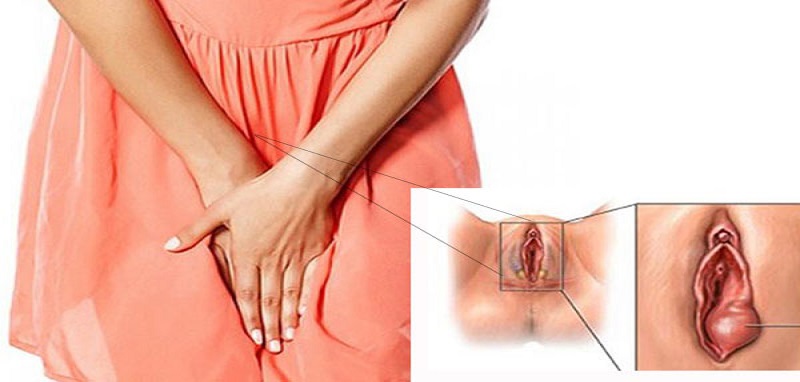 Có rất nhiều nguyên nhân bị sưng môi âm đạo