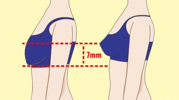 Ngực xệ ở tuổi dậy thì – Nguyên nhân và cách khắc phục 2